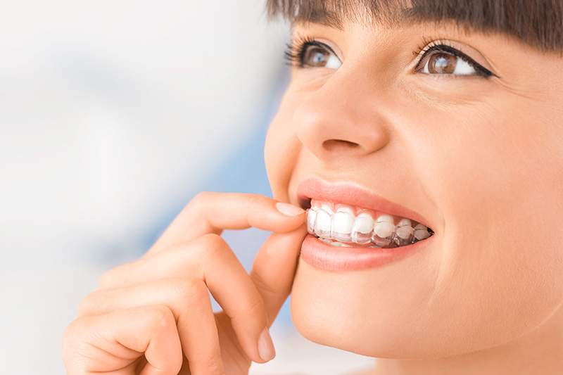 Invisalign® in Cincinnati
