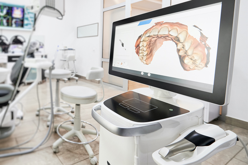 Intra-Oral Scanner in Cincinnati